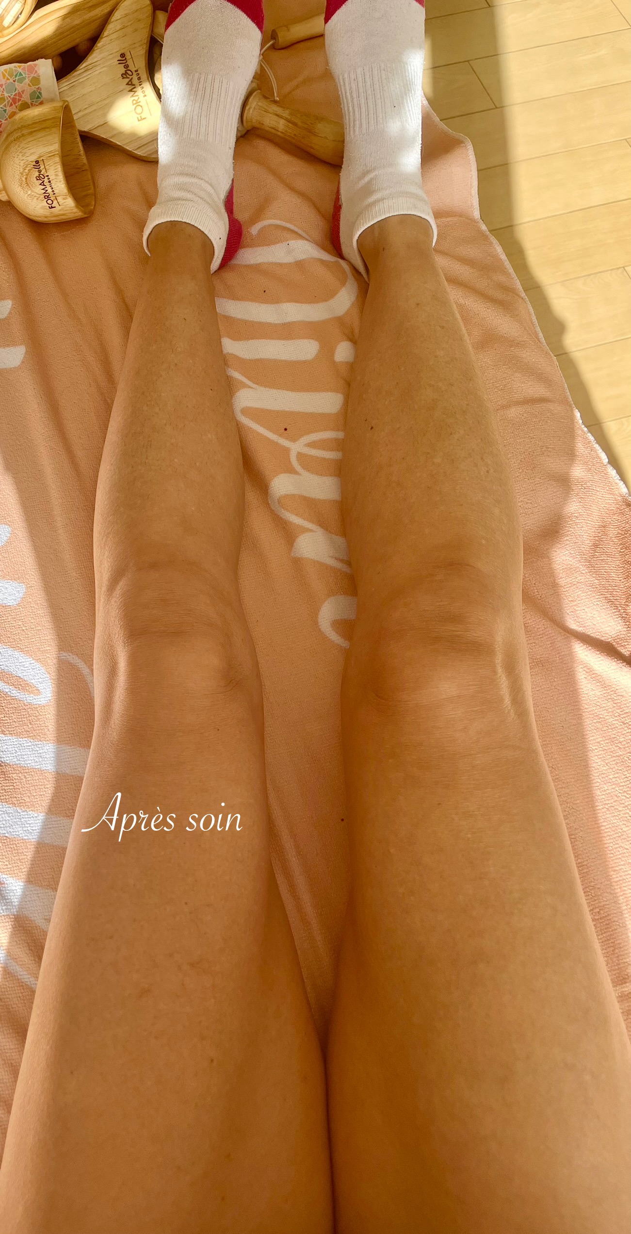 Après madérothérapie